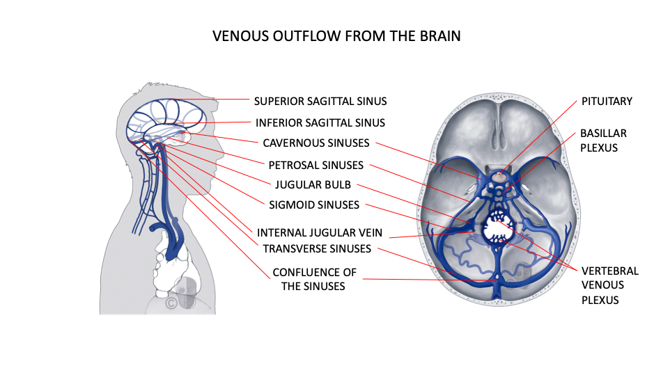 CFD Venous Outflow from the Brain