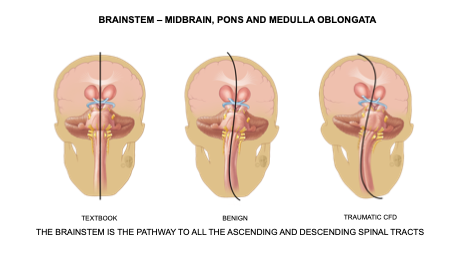 Brainstem - Midbrain, Pons and Medulla Oblongata